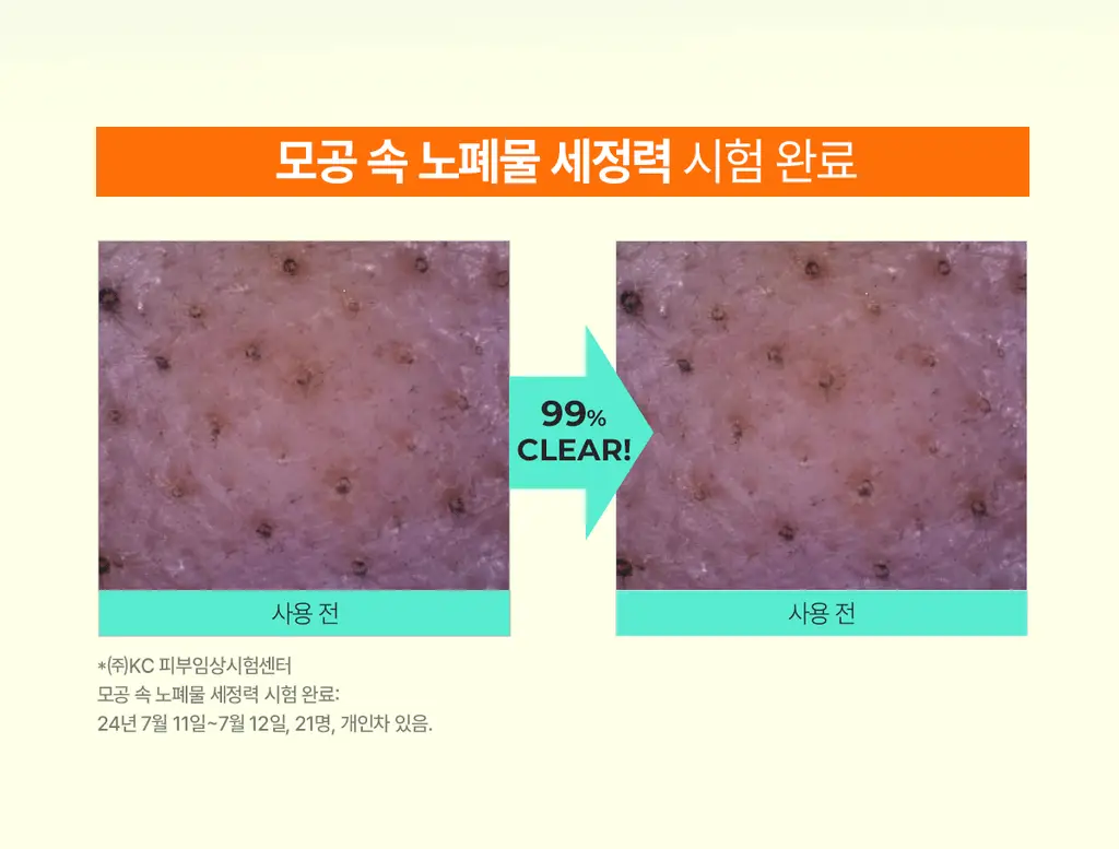 [올영단독100매] 포인트앤 딥 클린 올킬 클렌징티슈 100매 상세페이지 10
